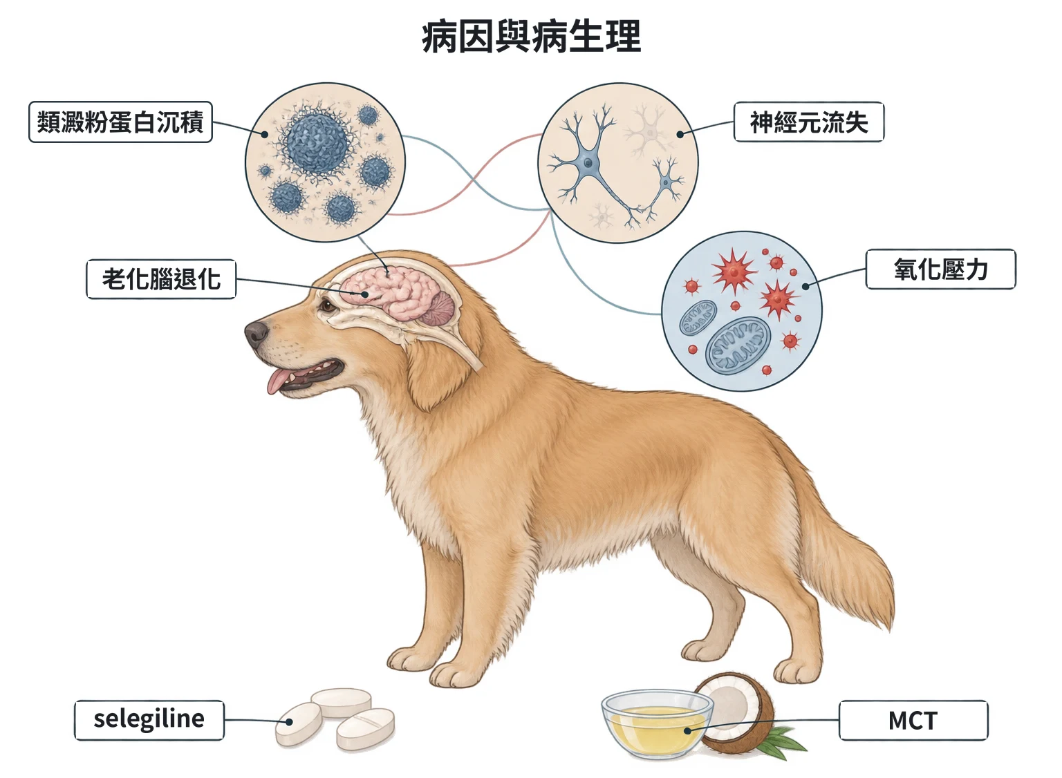 病因與病生理教學插圖