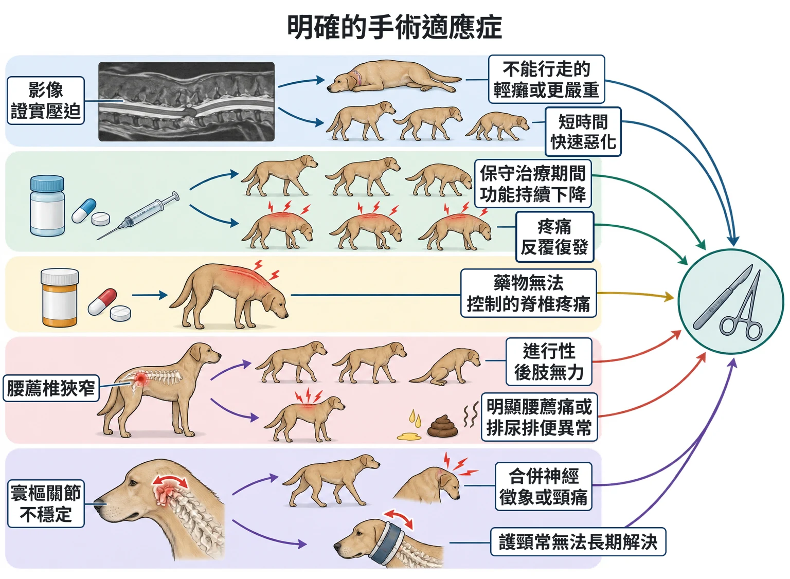 明確的手術適應症教學插圖