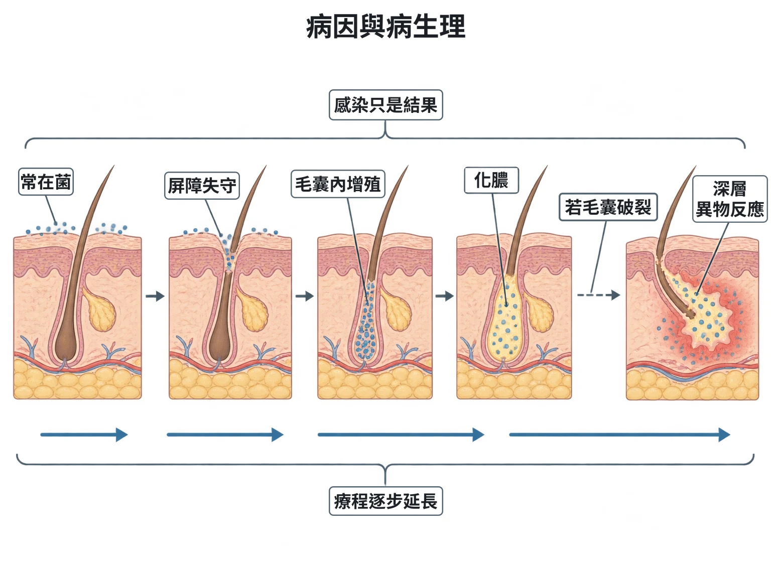 病因與病生理教學插圖