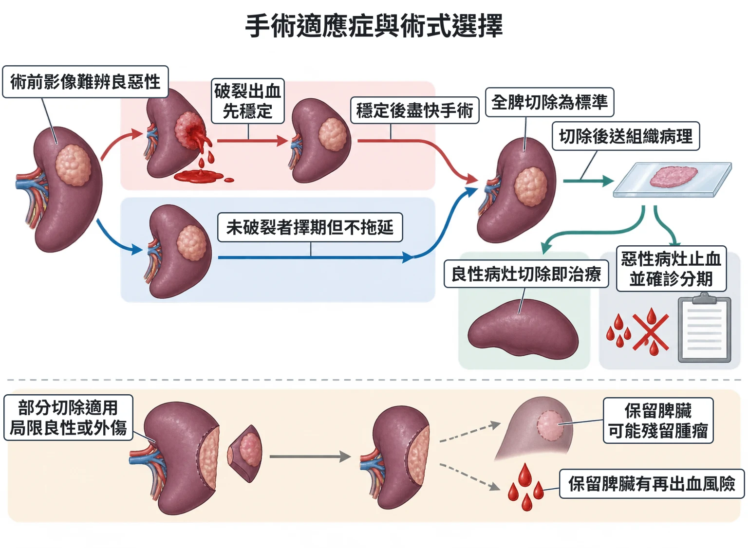 手術適應症與術式選擇教學插圖