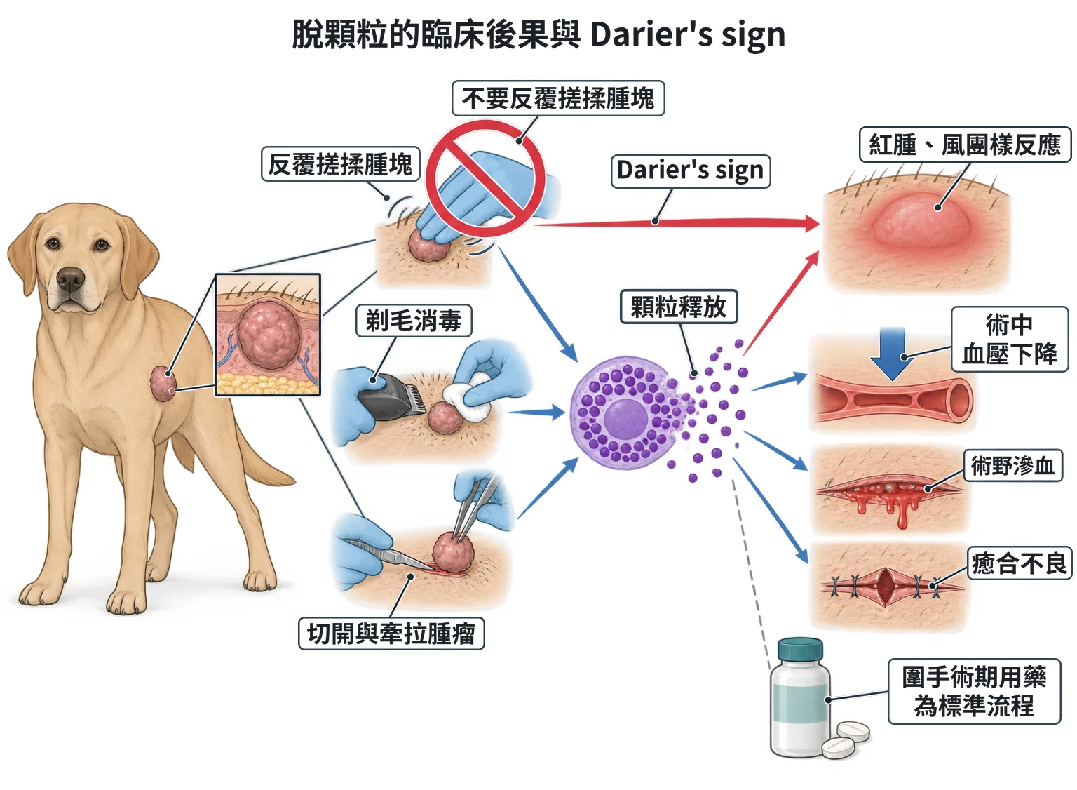 脫顆粒的臨床後果與 Darier's sign教學插圖