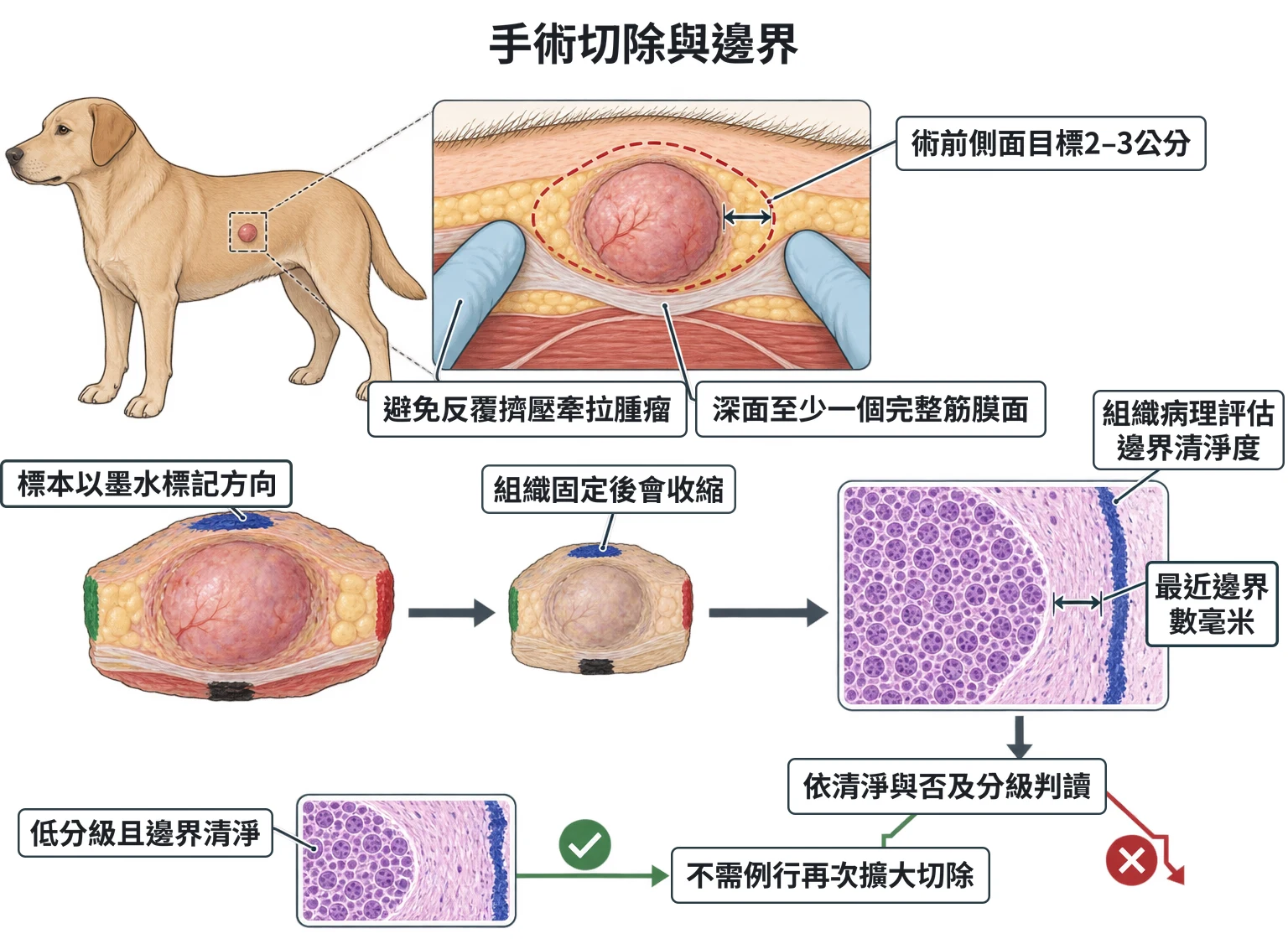 手術切除與邊界教學插圖