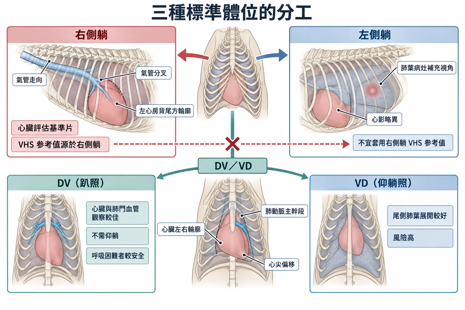 三種標準體位的分工教學插圖