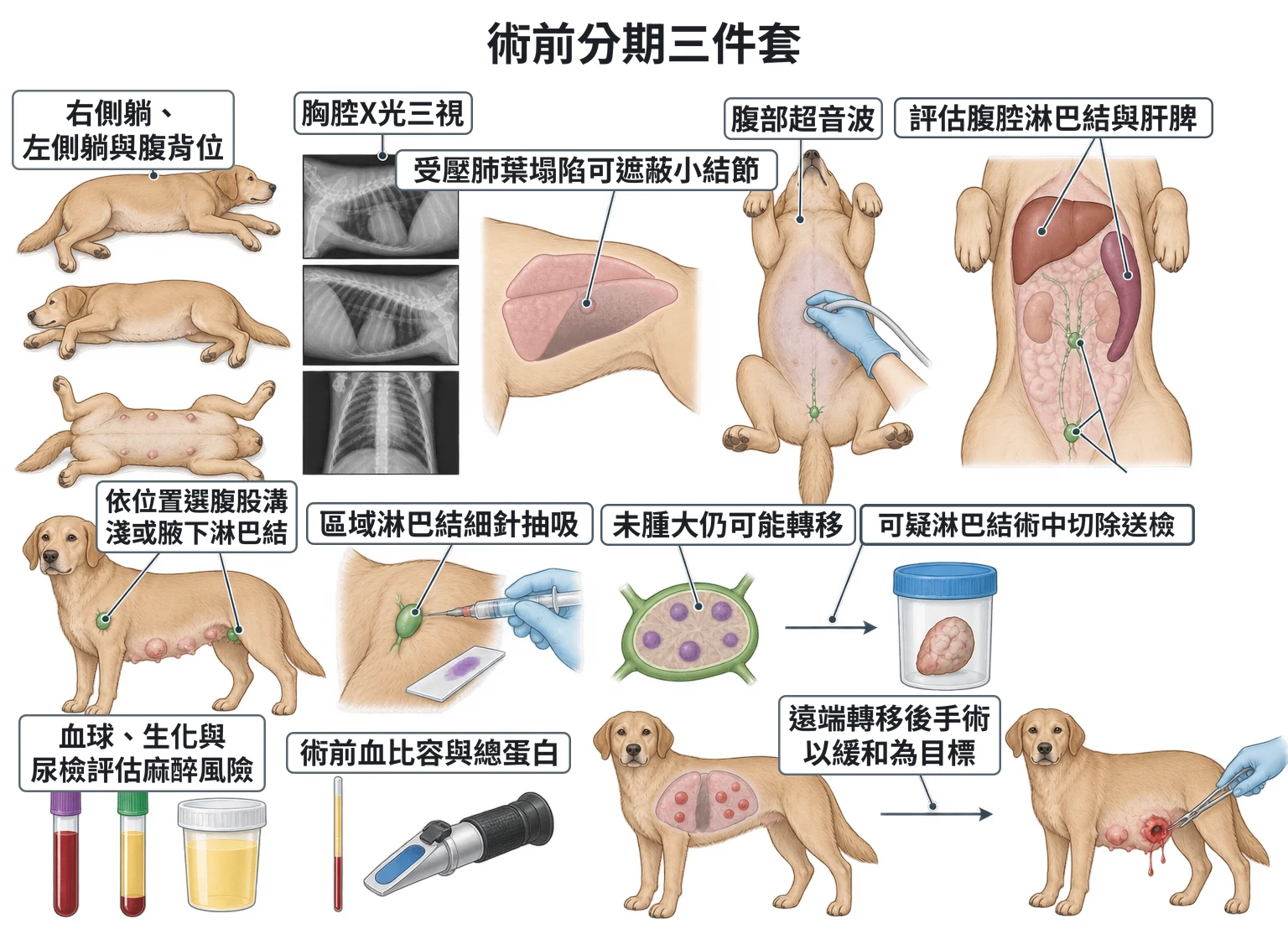 術前分期三件套教學插圖