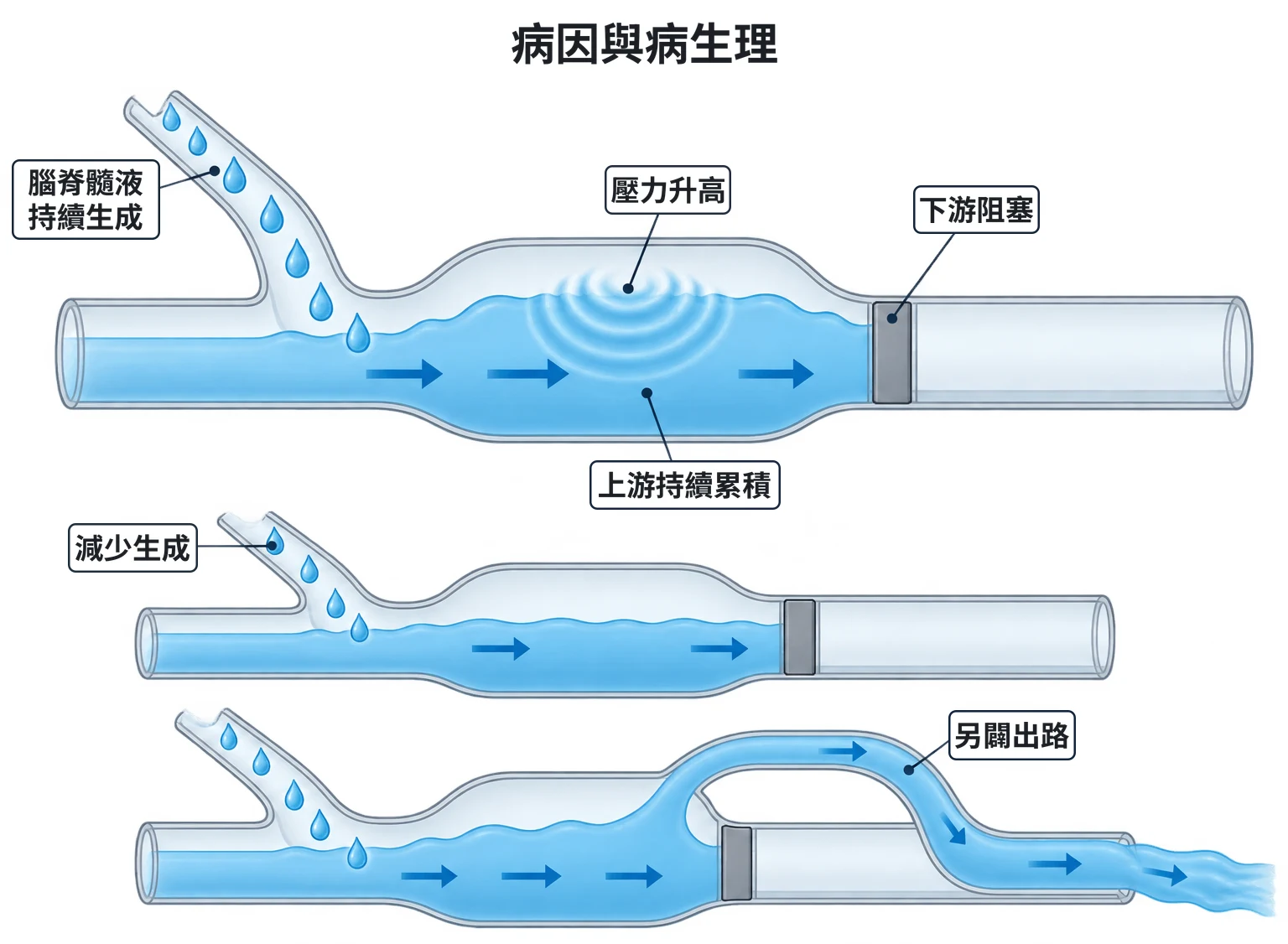 病因與病生理教學插圖