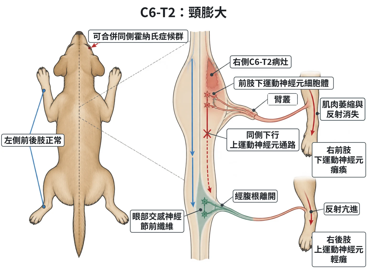C6-T2:頸膨大教學插圖