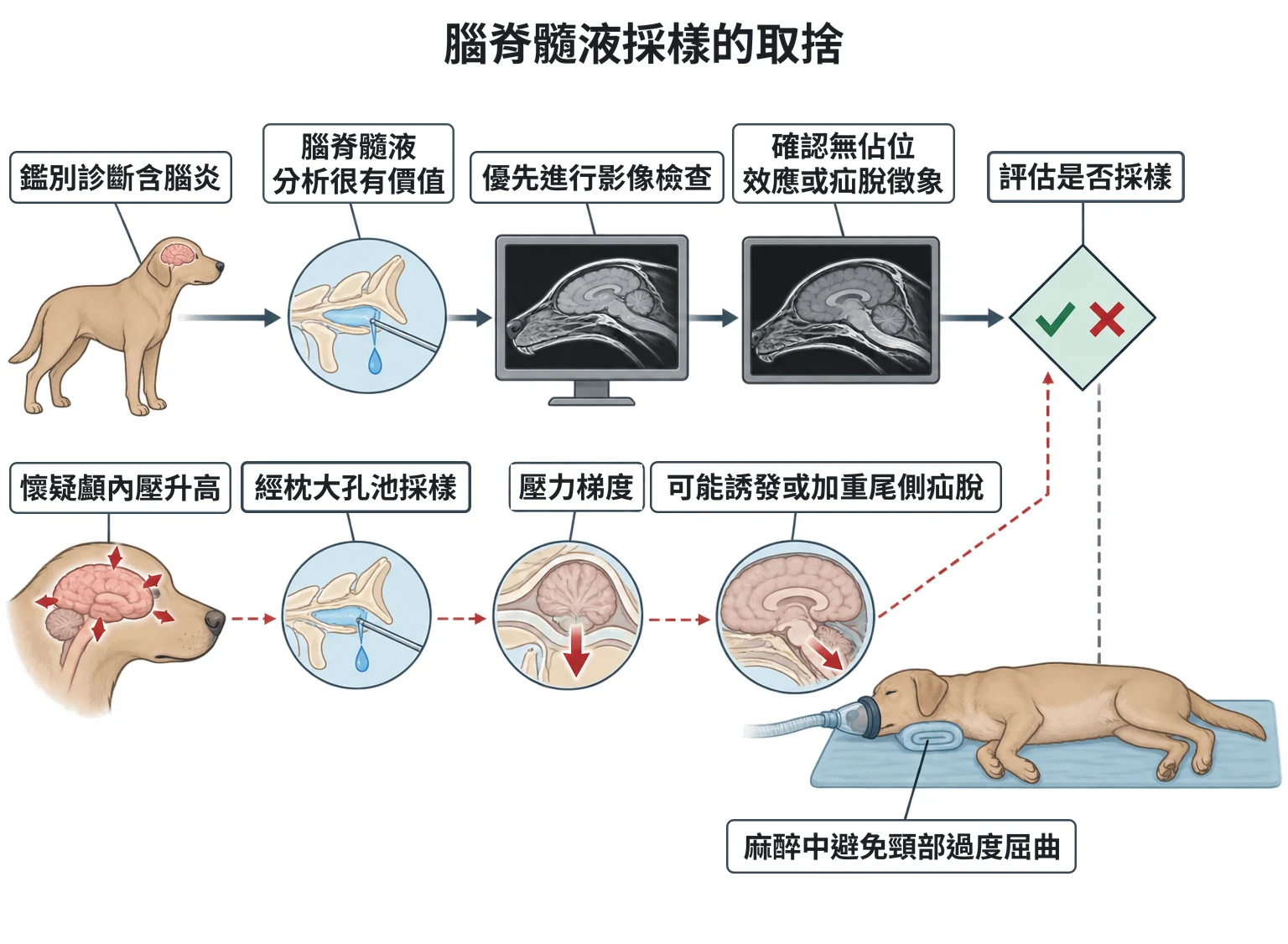 腦脊髓液採樣的取捨教學插圖