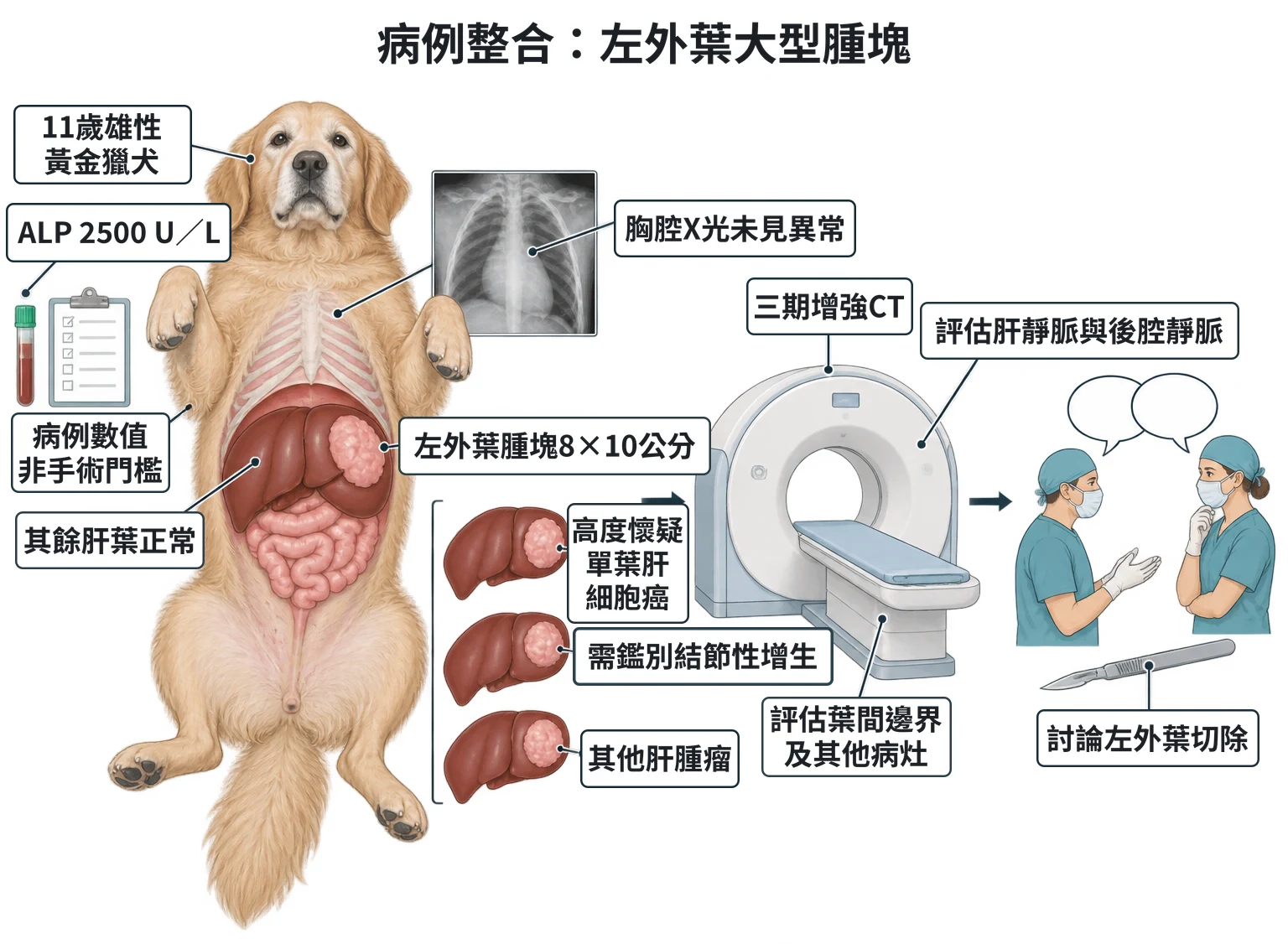病例整合:左外葉大型腫塊教學插圖
