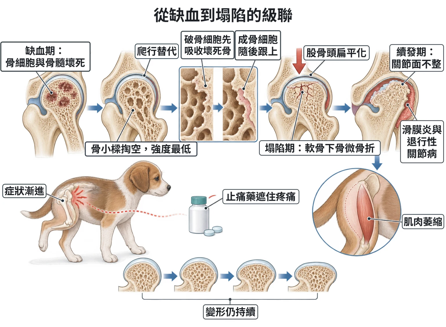 從缺血到塌陷的級聯教學插圖