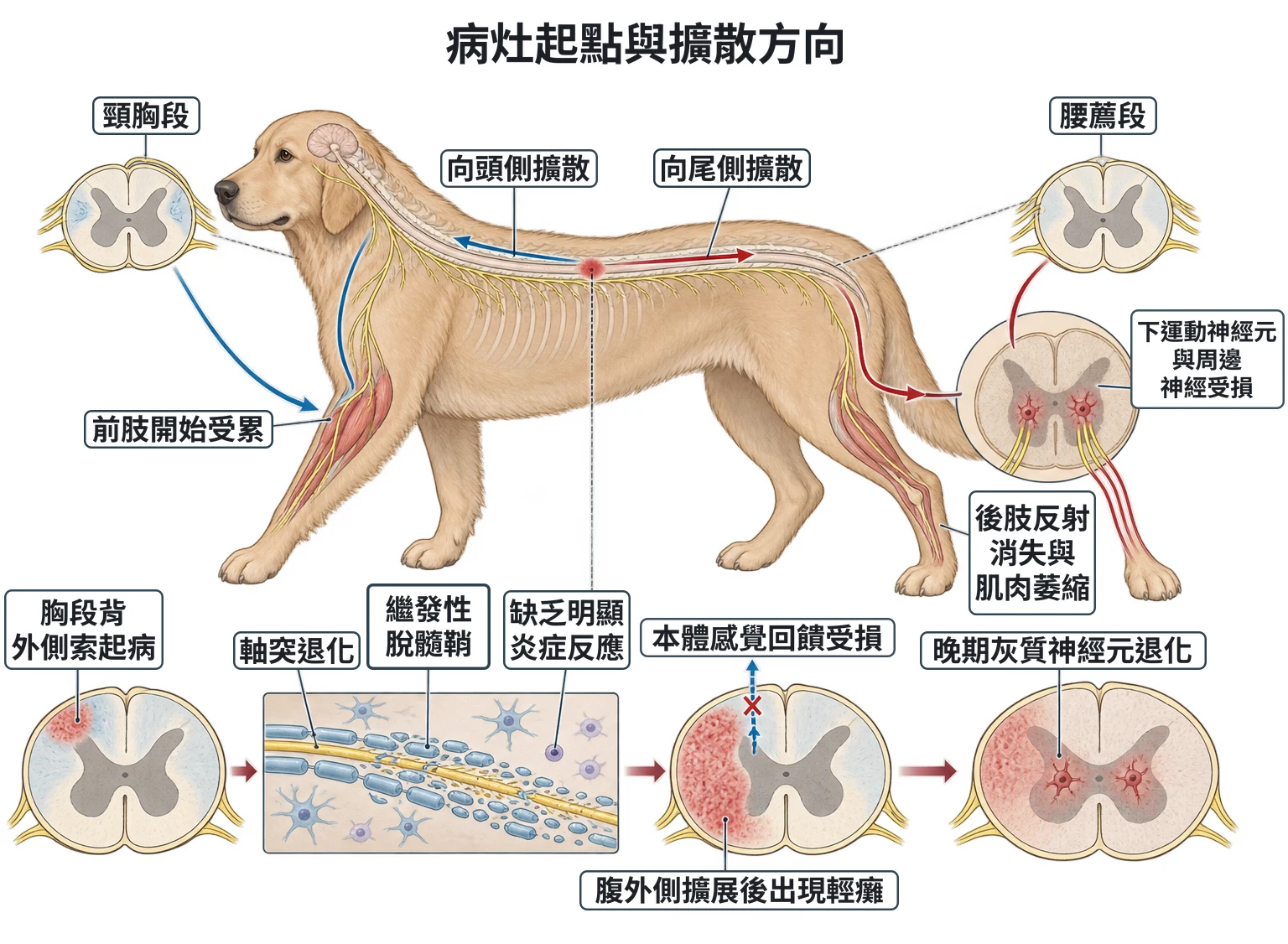 病灶起點與擴散方向教學插圖