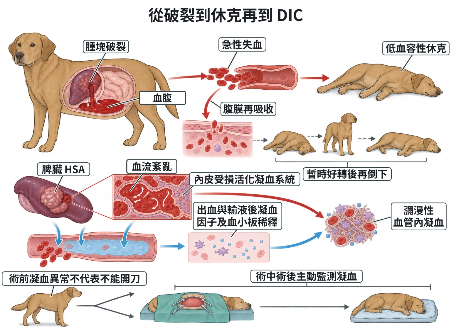 從破裂到休克再到 DIC教學插圖
