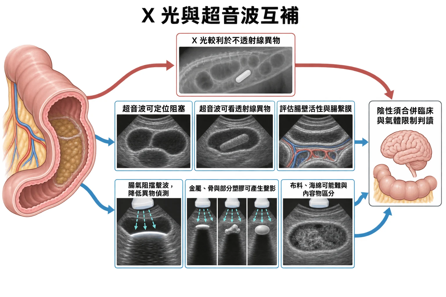 X 光與超音波互補教學插圖