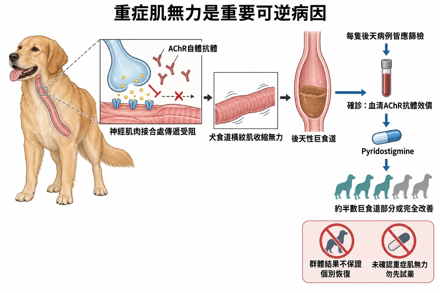 重症肌無力是重要可逆病因教學插圖