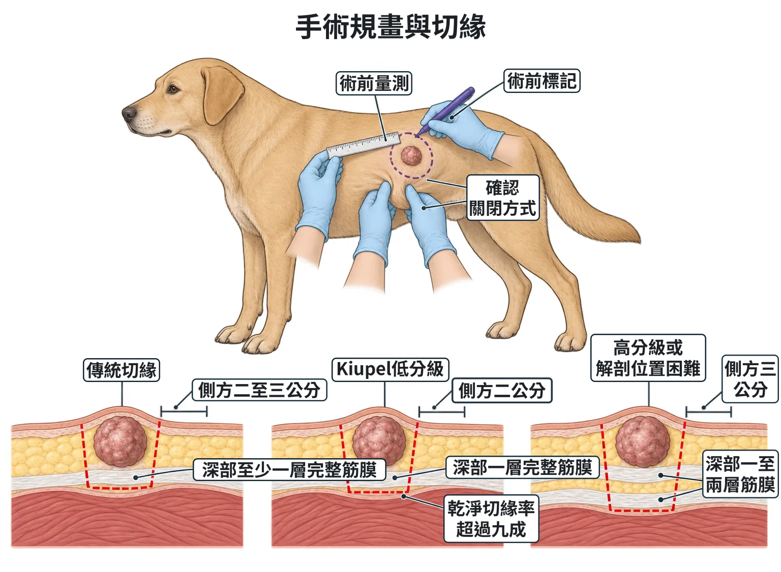 手術規畫與切緣教學插圖