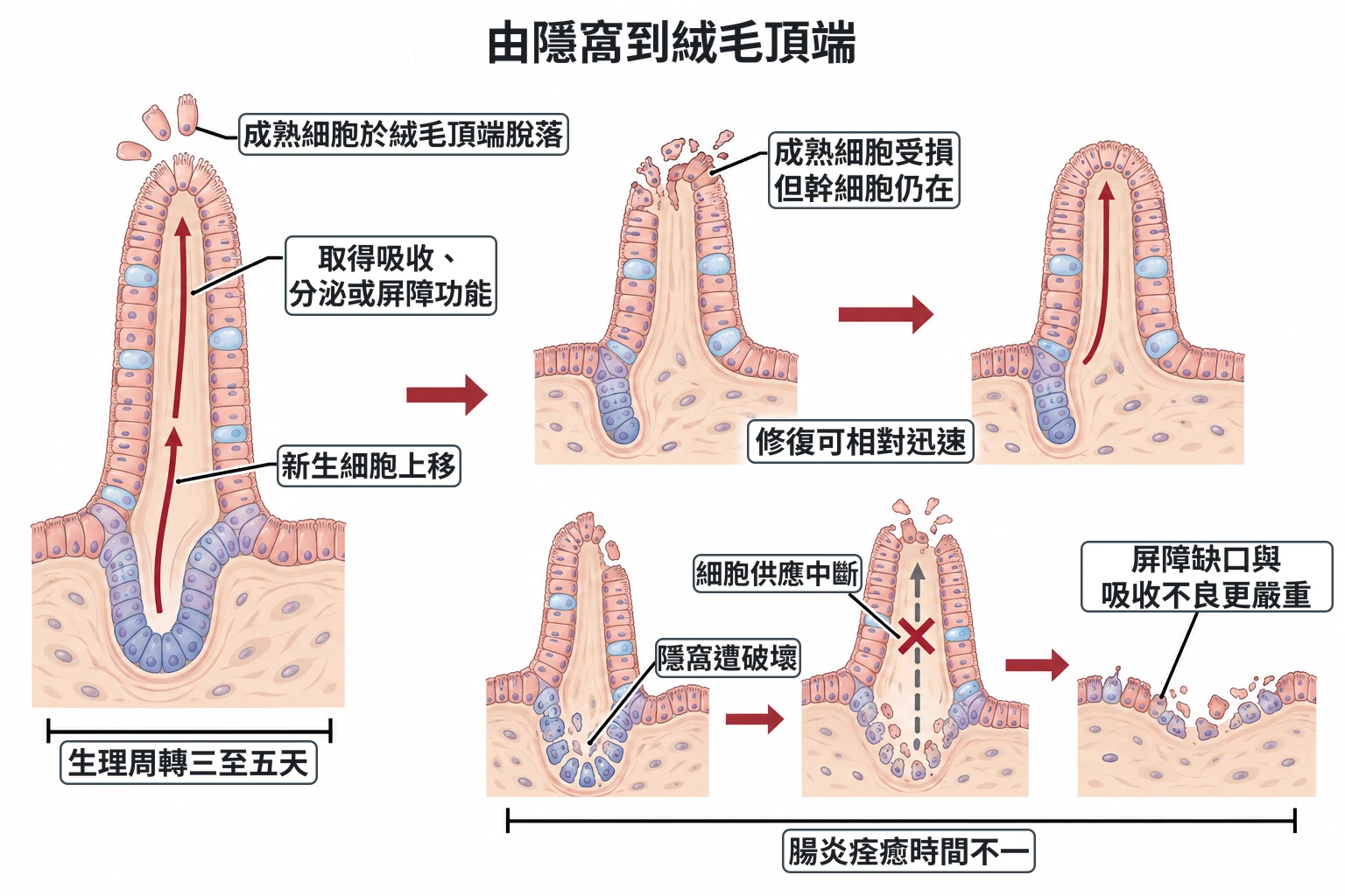 由隱窩到絨毛頂端教學插圖