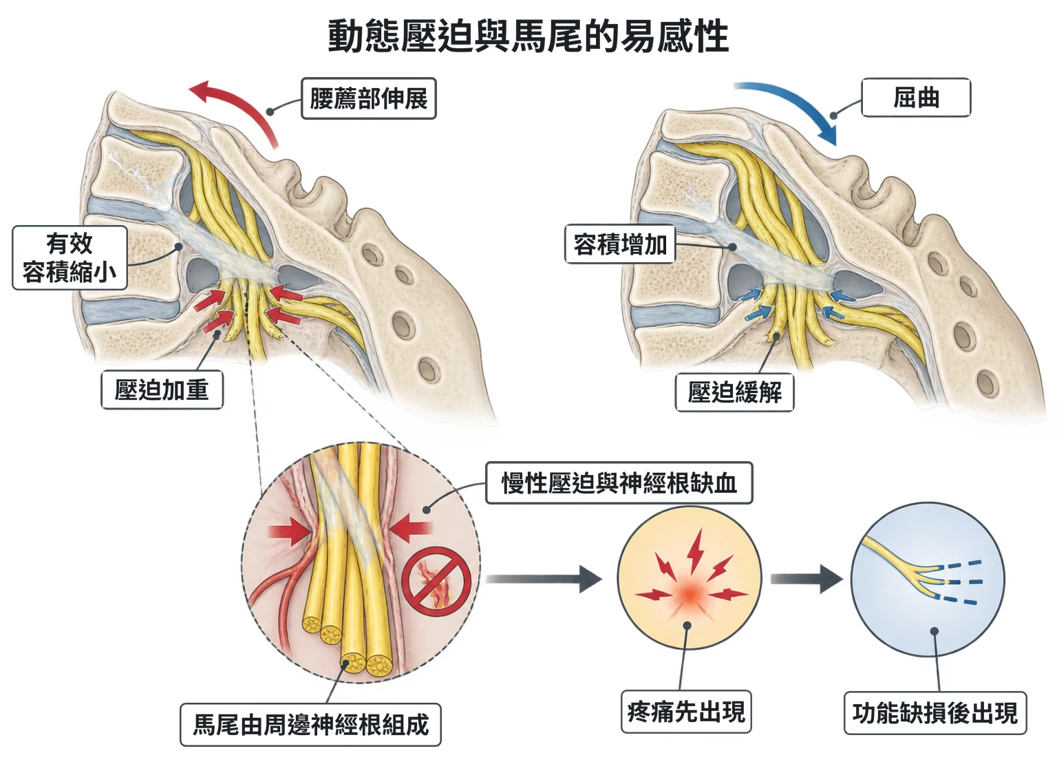 動態壓迫與馬尾的易感性教學插圖