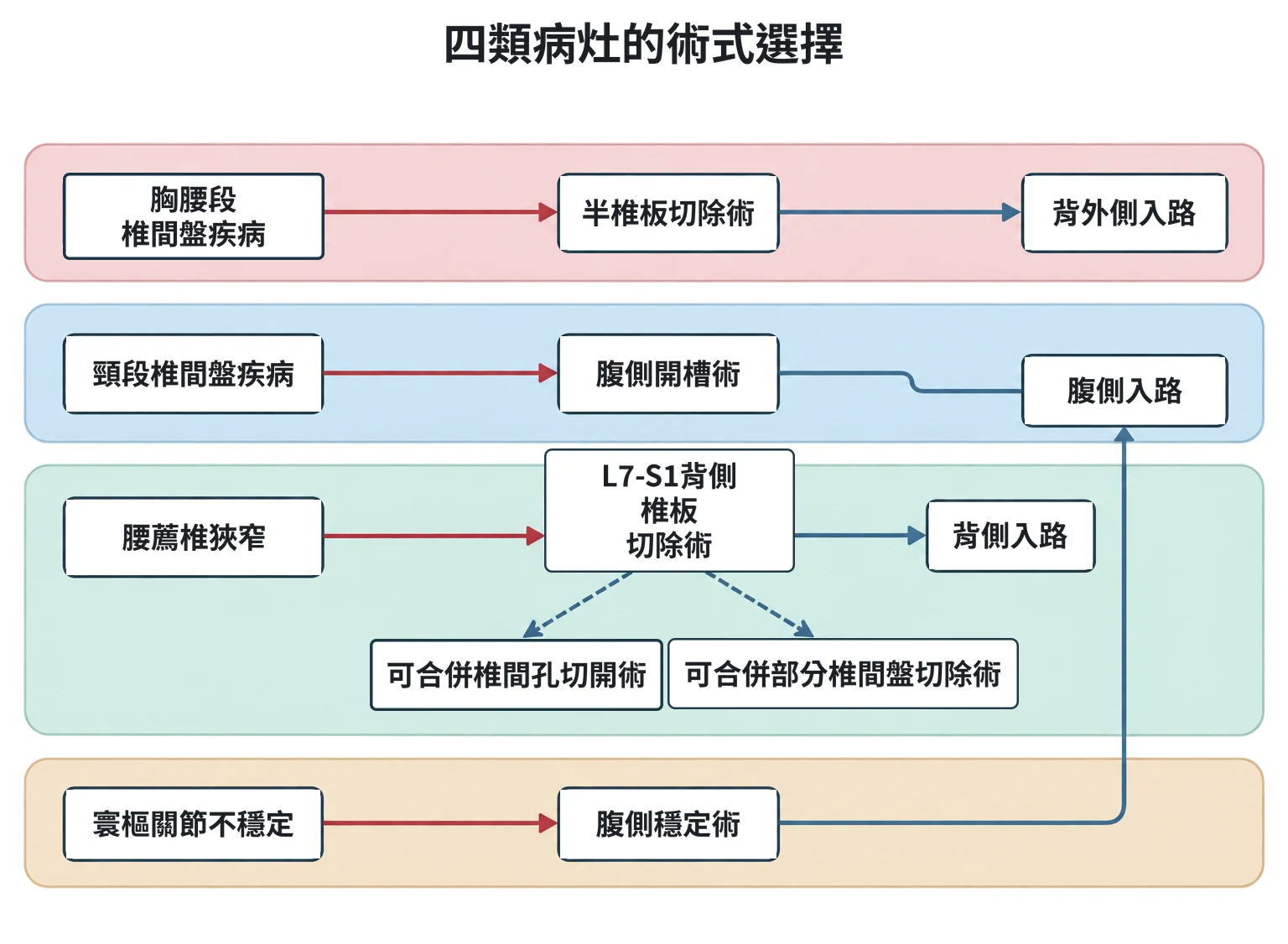 四類病灶的術式選擇教學插圖