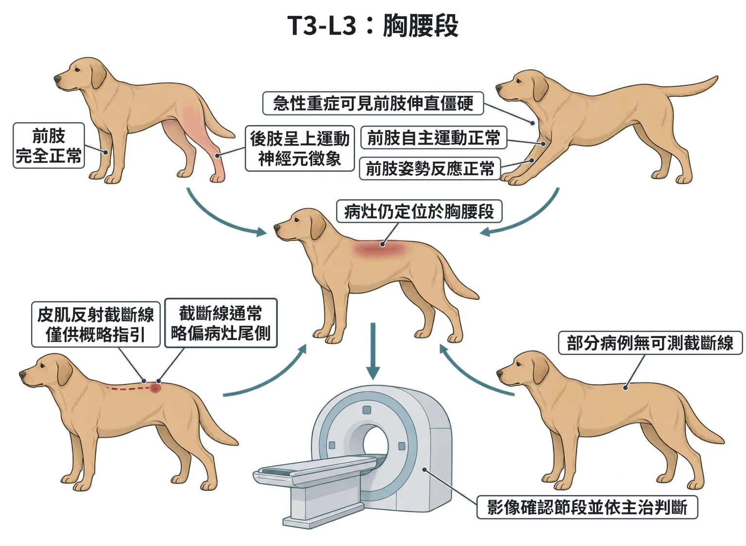 T3-L3:胸腰段教學插圖