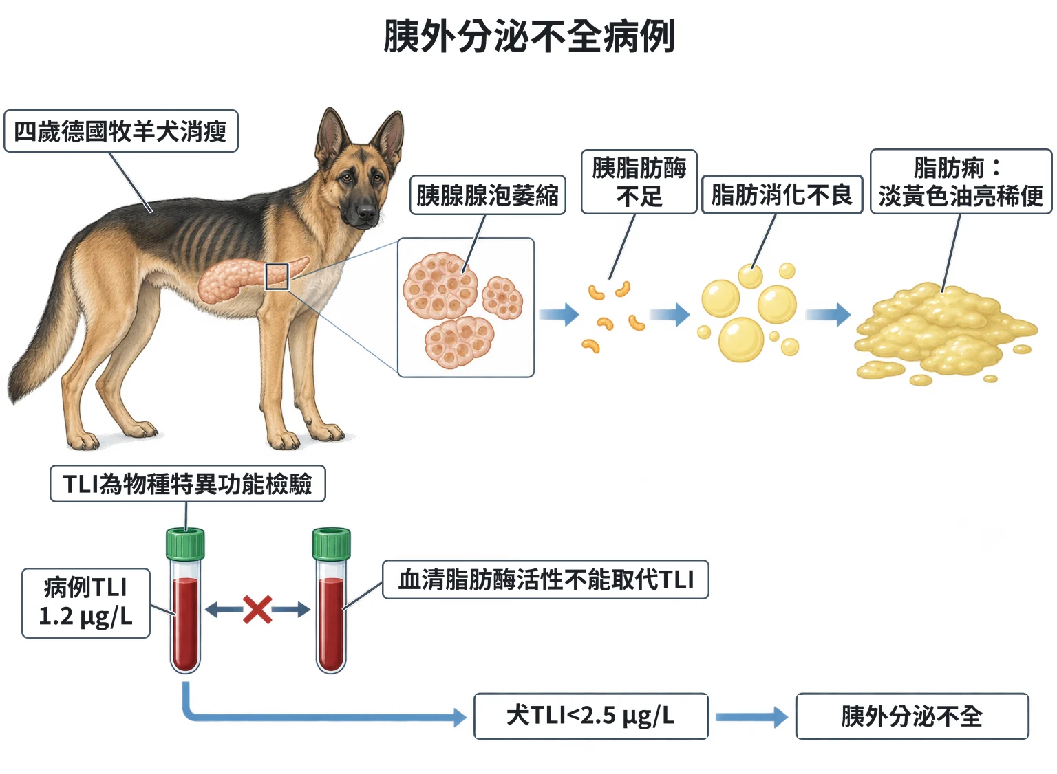 胰外分泌不全病例教學插圖