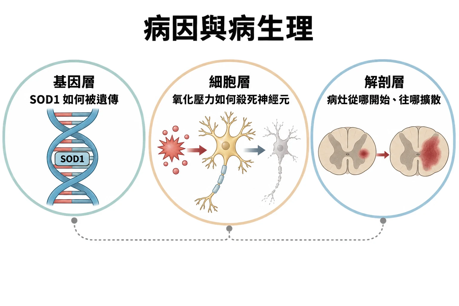 病因與病生理教學插圖