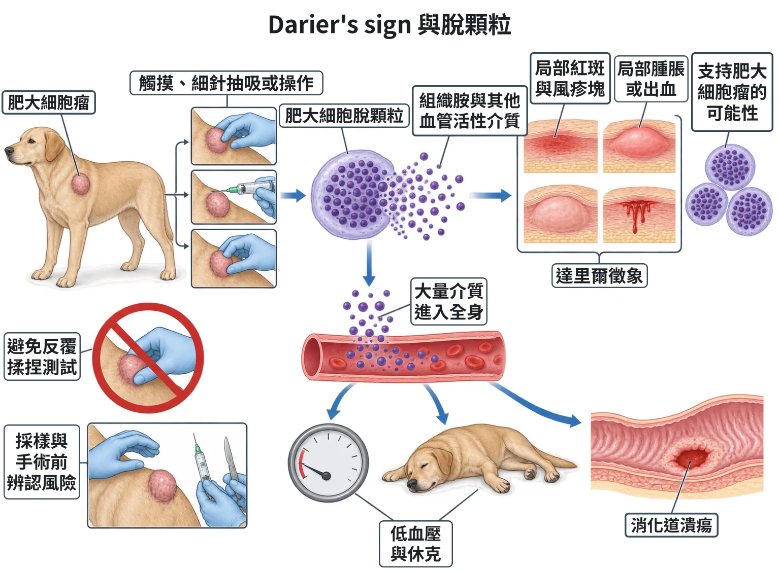 Darier's sign 與脫顆粒教學插圖