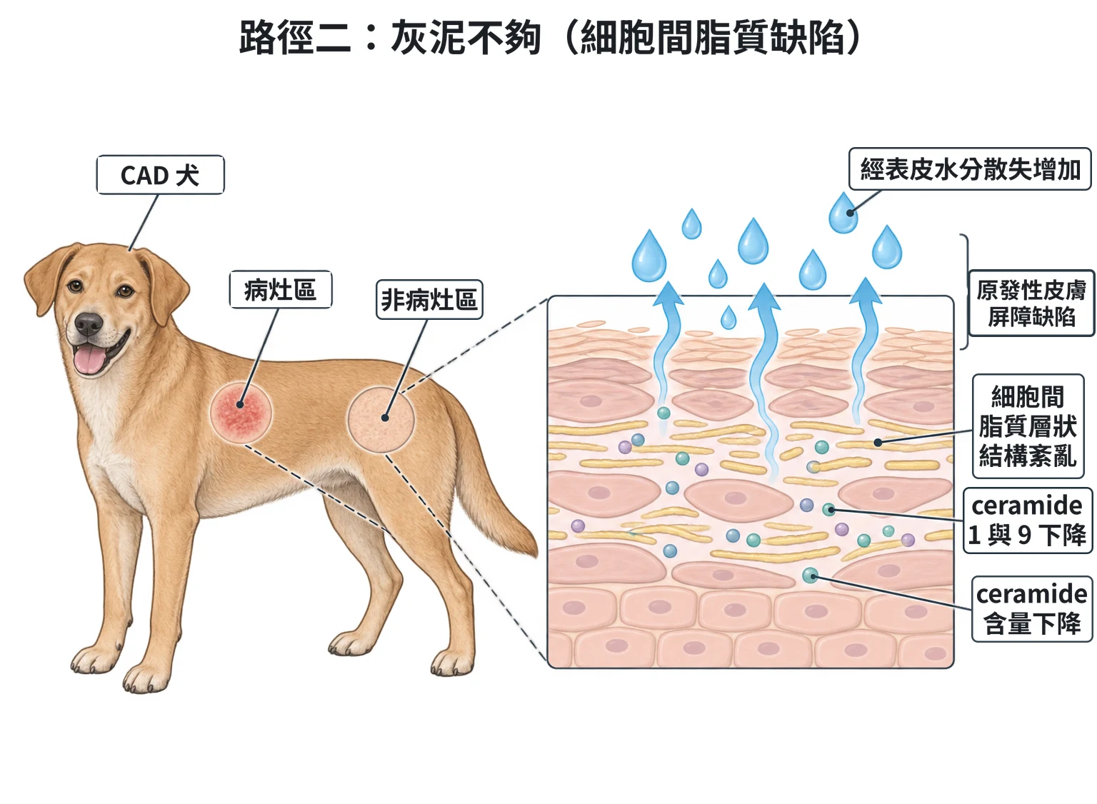 路徑二:灰泥不夠(細胞間脂質缺陷)教學插圖