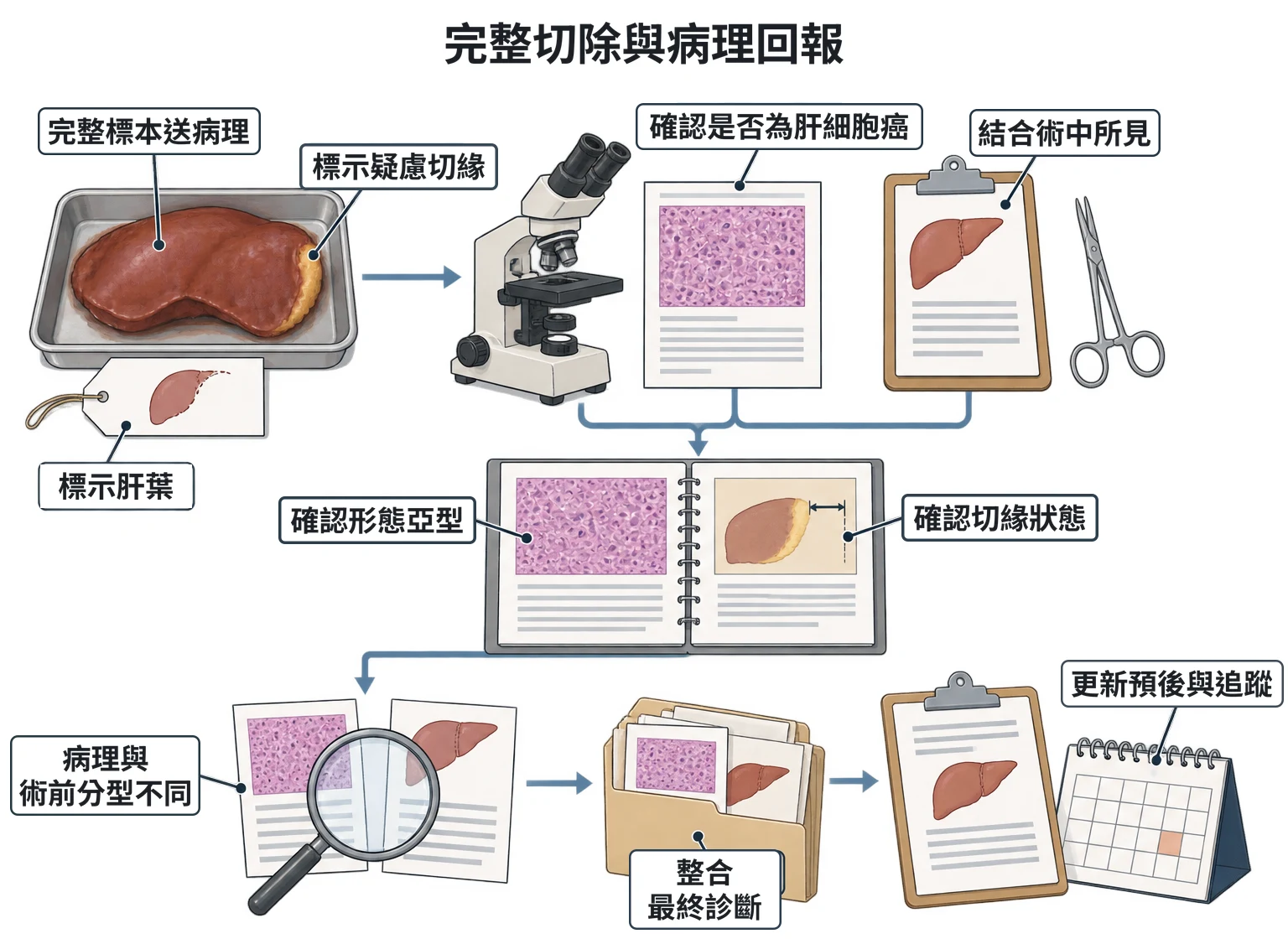 完整切除與病理回報教學插圖
