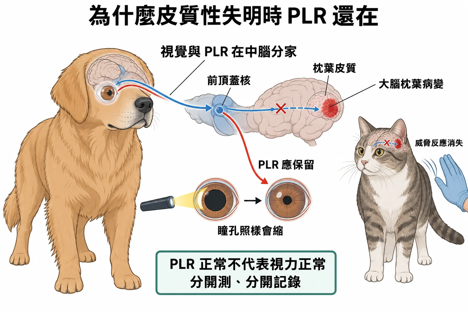 為什麼皮質性失明時 PLR 還在教學插圖