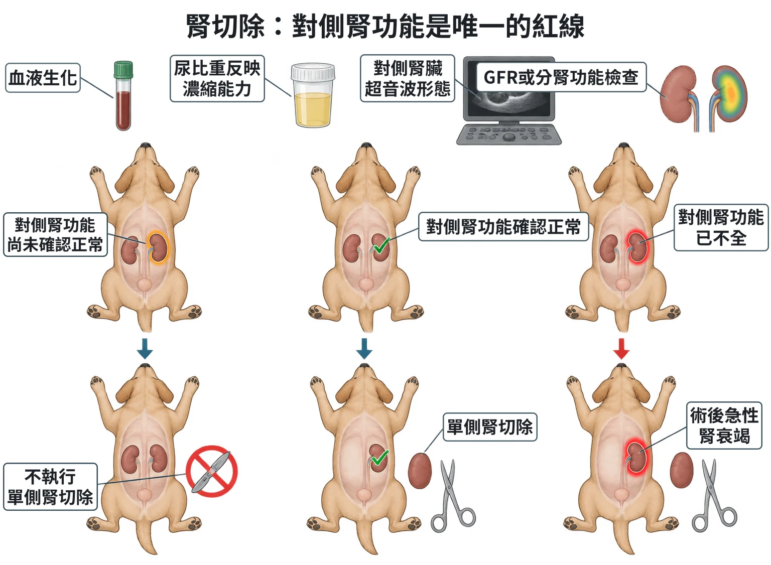 腎切除:對側腎功能是唯一的紅線教學插圖