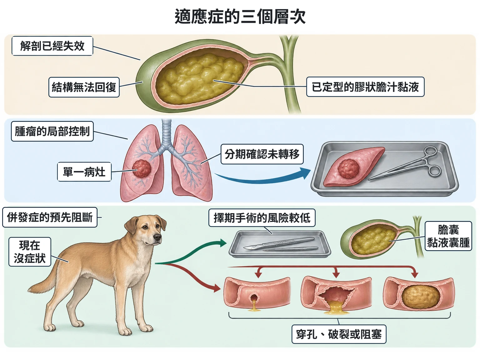 適應症的三個層次教學插圖