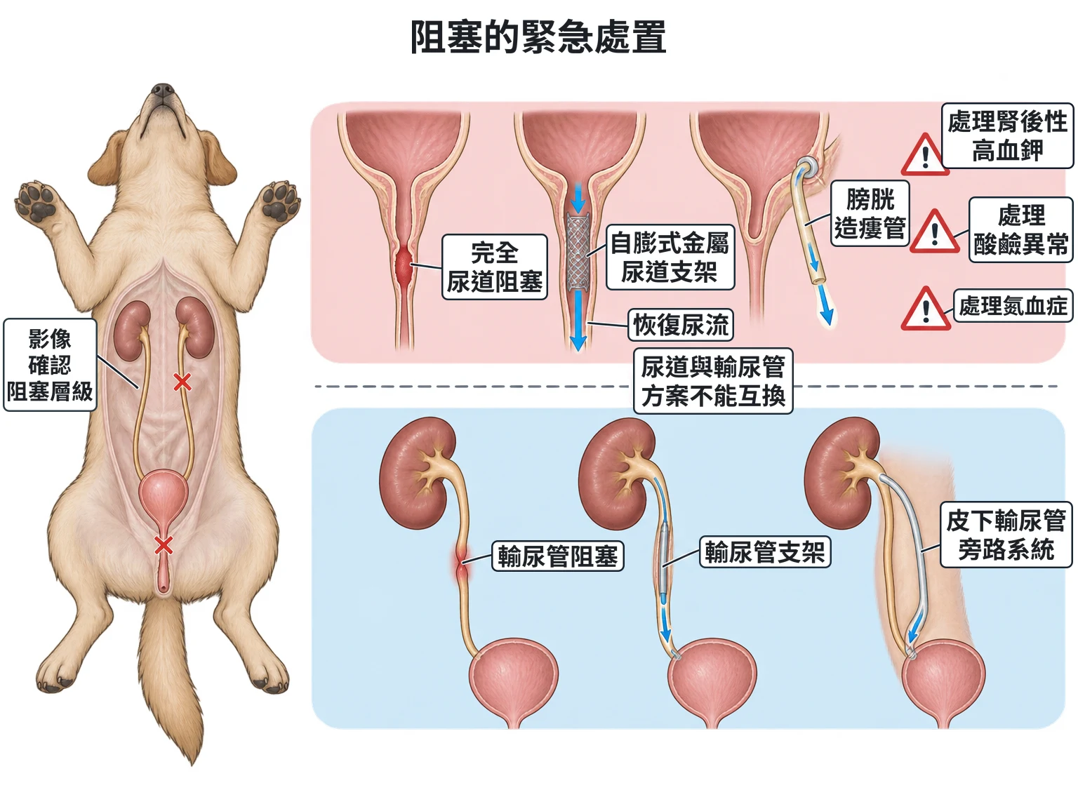 阻塞的緊急處置教學插圖