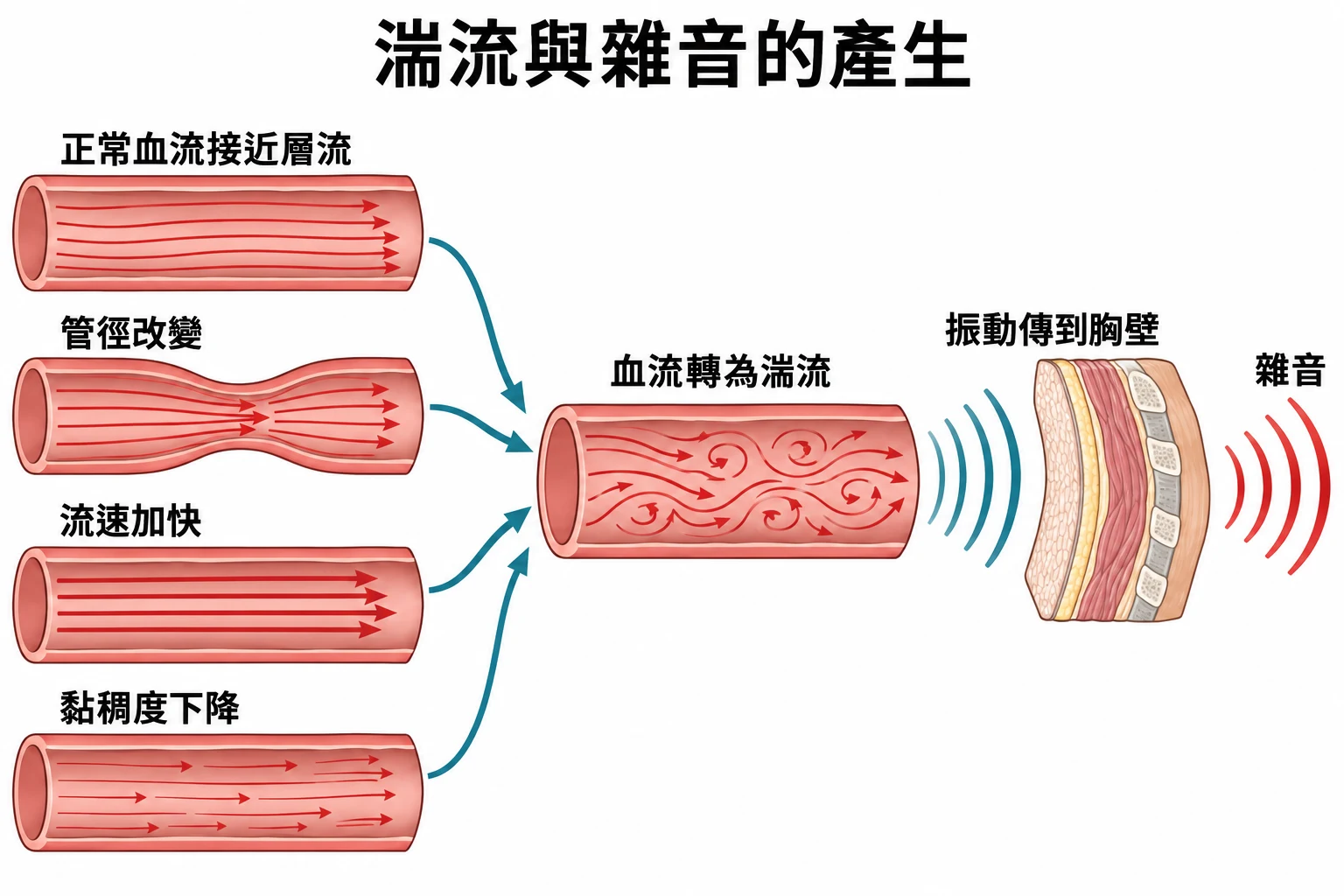 湍流與雜音的產生教學插圖