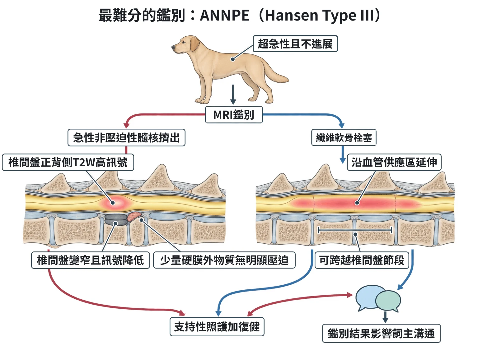 最難分的鑑別:ANNPE(Hansen Type III)教學插圖