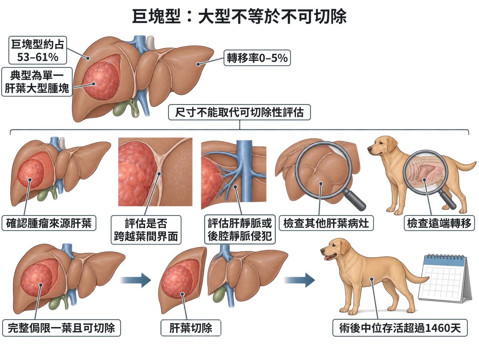 巨塊型:大型不等於不可切除教學插圖