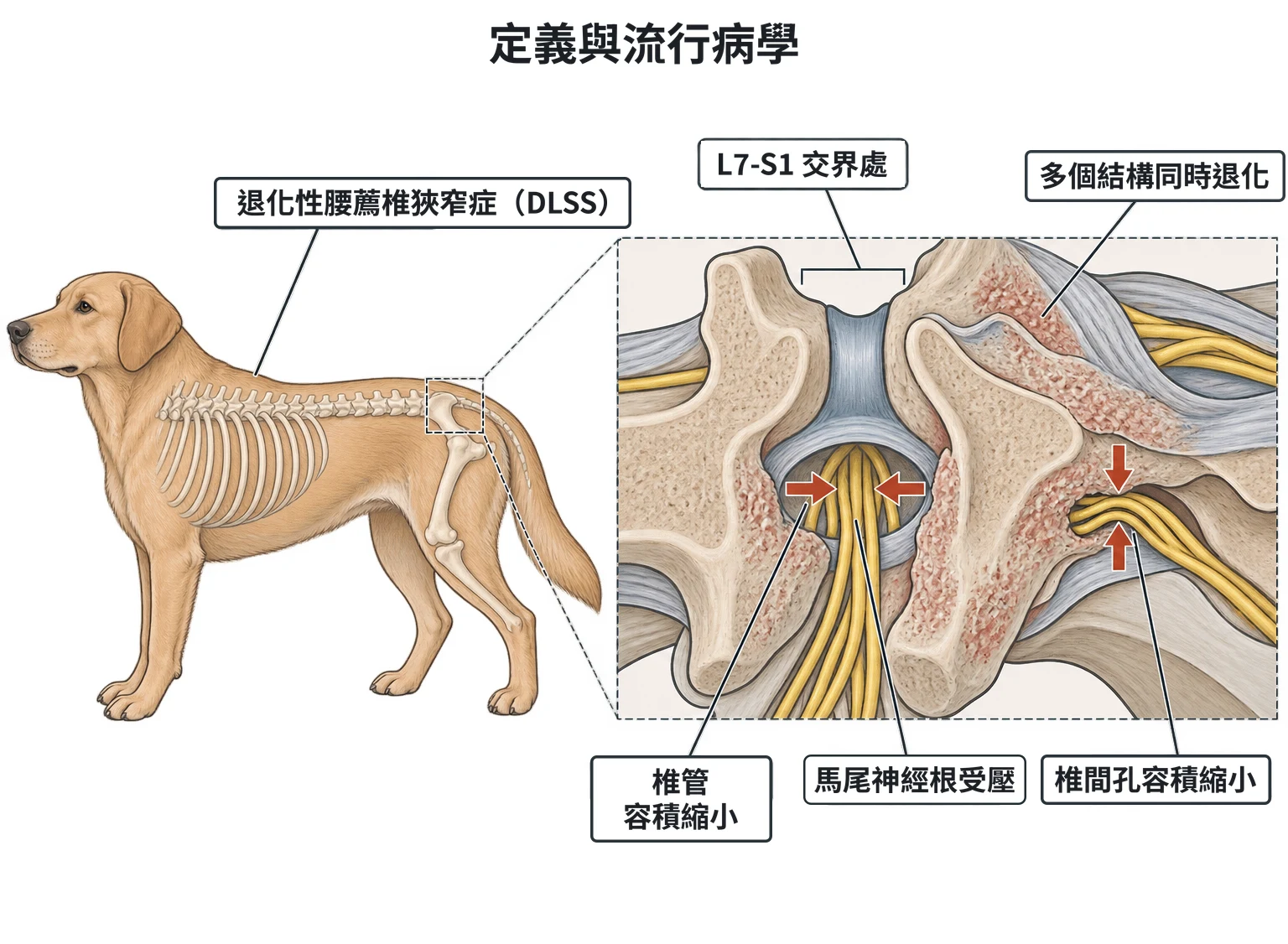 定義與流行病學教學插圖