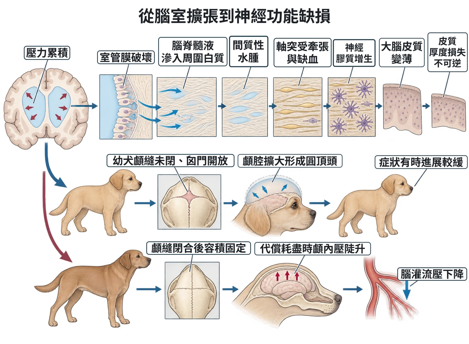 從腦室擴張到神經功能缺損教學插圖