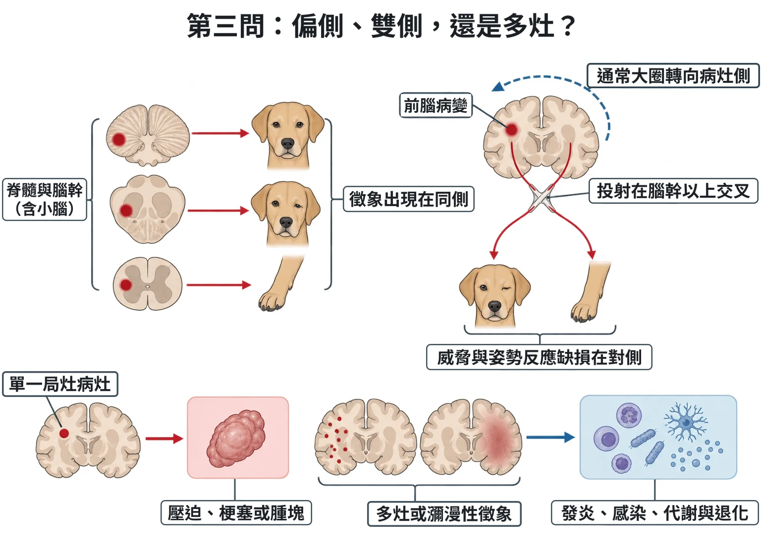 第三問:偏側、雙側,還是多灶?教學插圖