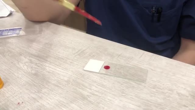 血液採樣(血片)操作2 縮圖