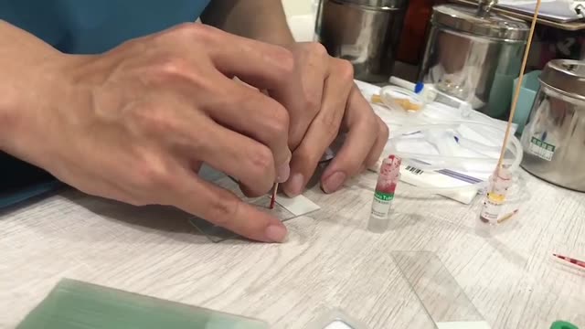 血液採樣(血片)操作3 縮圖