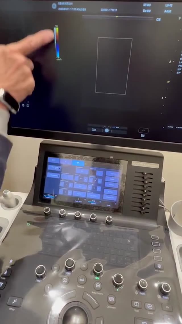 超音波機操作5 縮圖